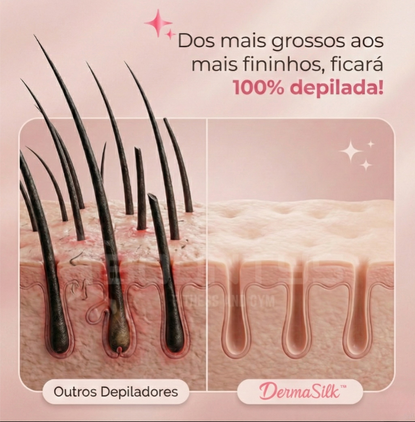 Depilador Elétrico 4 em 1 - DermaSilk™.