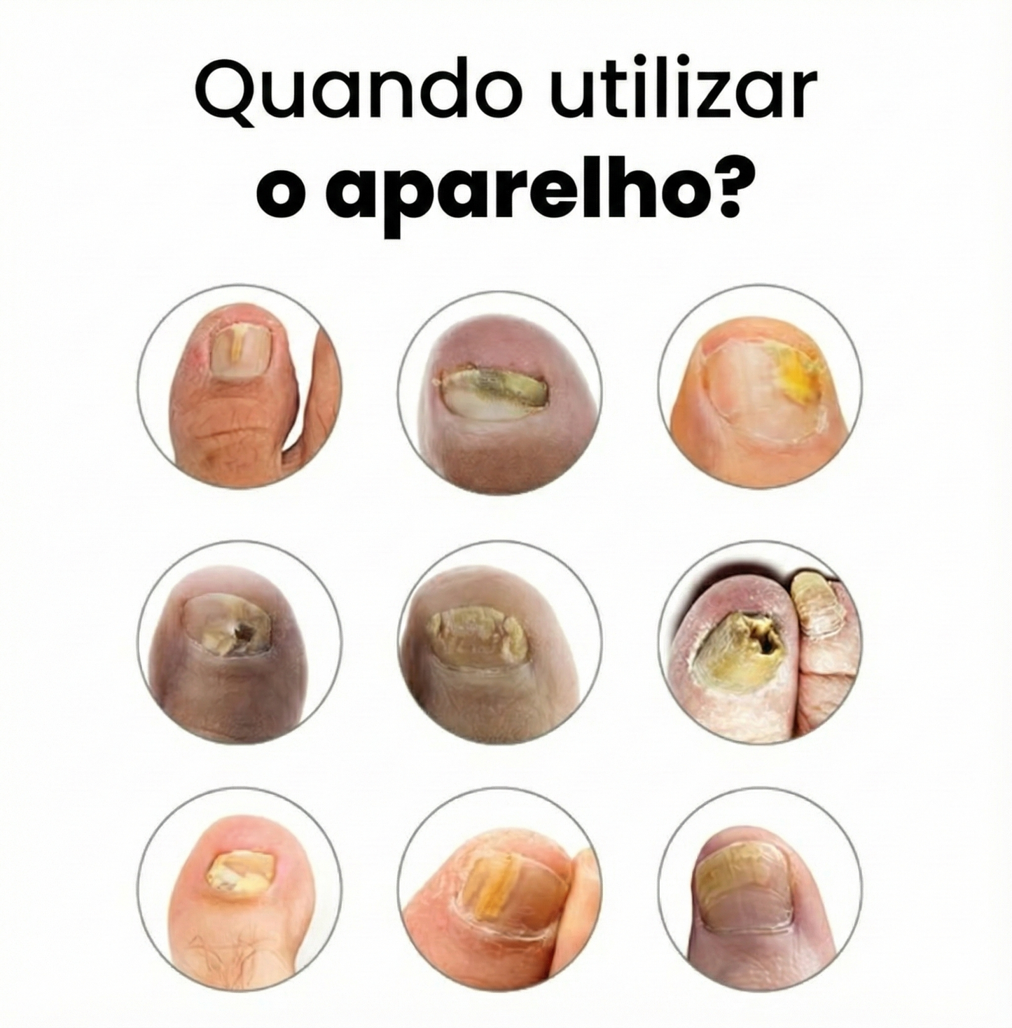 Aparelho OrtoVida